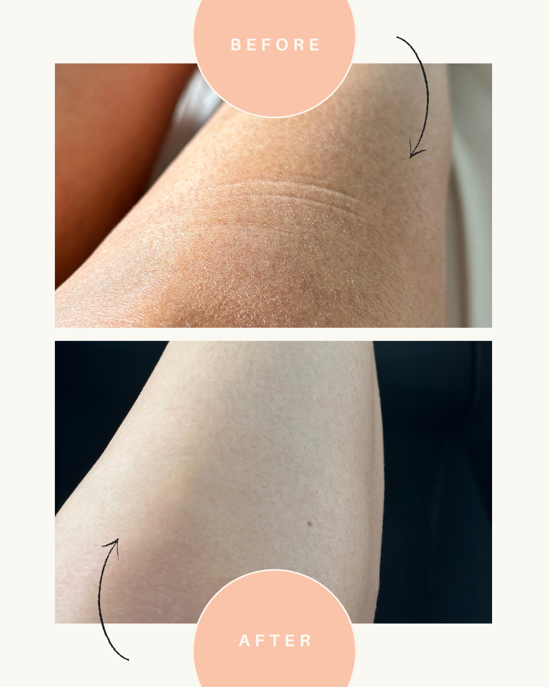 Bare Body | Bestie Bundle
